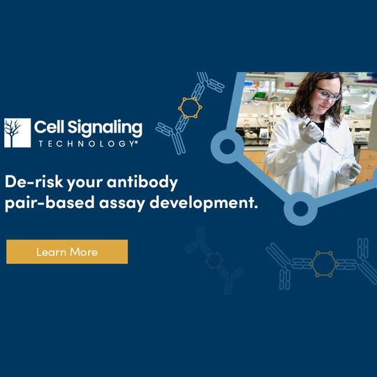 Scientist pipetting in lab beside text reading “De-risk your antibody pair-based assay development – Learn More. 