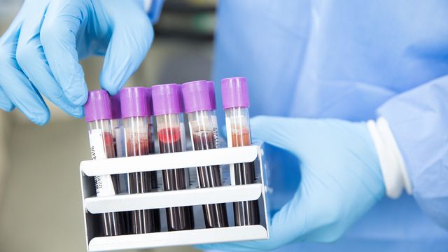 A scientist in gloves and an overall holds a rack of purple topped blood sample tubes and goes to pick one out. 