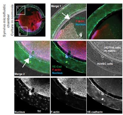 Figure 2: Example use of microfluidic chambers to allow the observation of cell migration, change of nuclear shape and cytoskeleton organization during invasion by HCT116 cells, from the tissue compartment to the HUVEC-containing endothelial compartment. Credit: Tebubio. Microscope images showing use of microfluidic chambers to allow the observation of cell migration, change of nuclear shape and cytoskeleton organization during invasion by HCT116 cells, from the tissue compartment to the HUVEC-containing endothelial compartment.