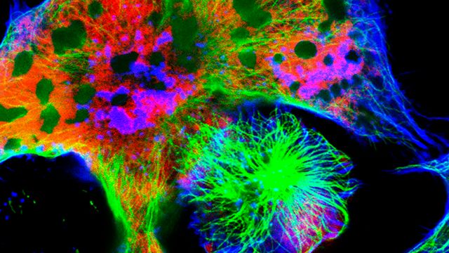 Fluorescently stained mice neuroblastoma cells. 
