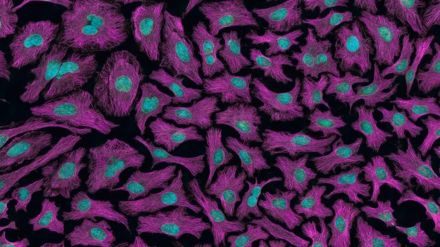 Cells from cervical cancer in blue and pink against a black background. 