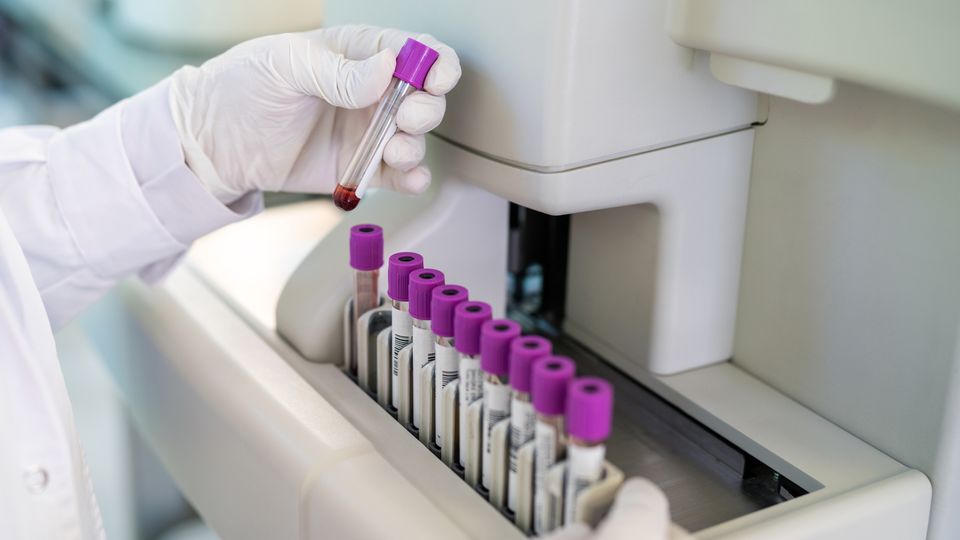 Laboratory technician handling blood sample vials for analysis in the Blood Protein Atlas project.
